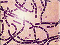 anthrax, Bacillus anthracis